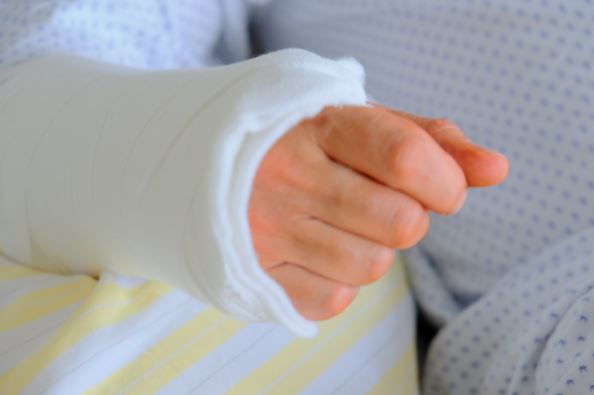 Everything You Need to Know About Arm Fractures in Children